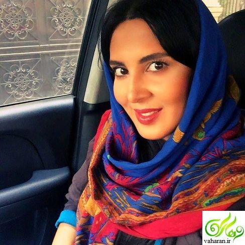 عکسهای جدید لیلا بلوکات بعد از عمل زیبایی آبان 95