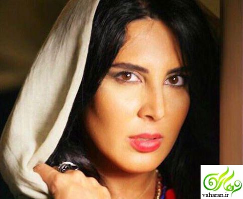 عکسهای جدید لیلا بلوکات بعد از عمل زیبایی آبان 95