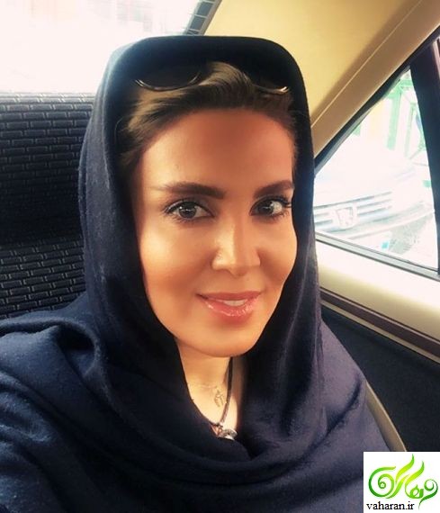 عکسهای جدید لیلا بلوکات بعد از عمل زیبایی آبان 95
